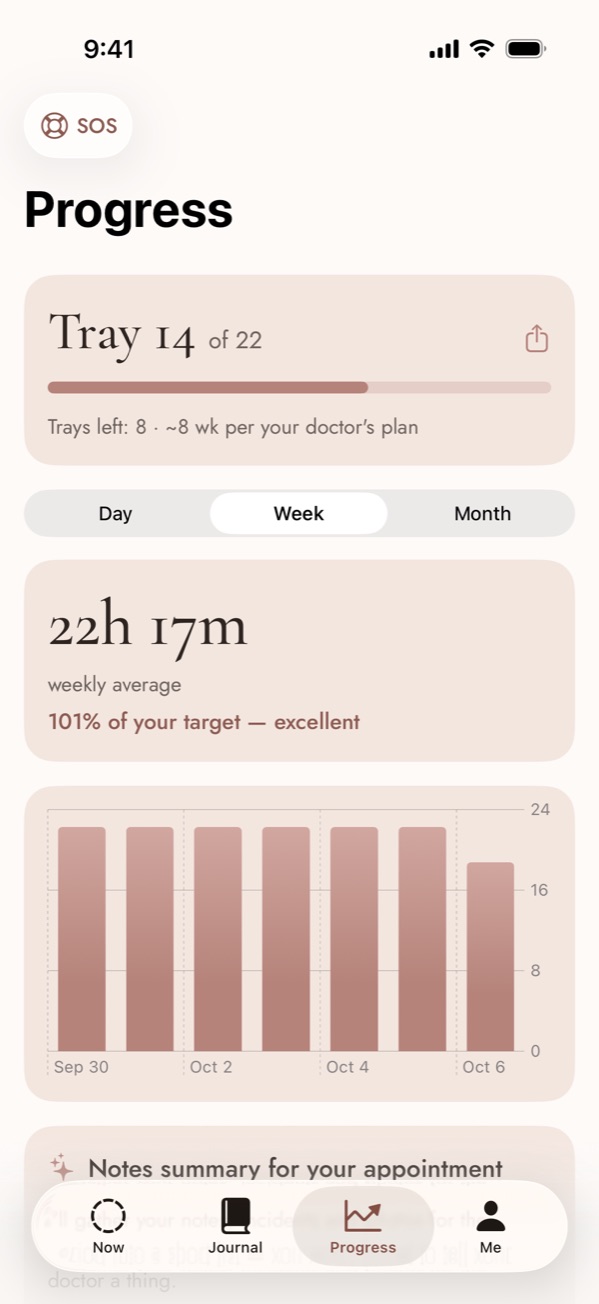 Aliner — progress
